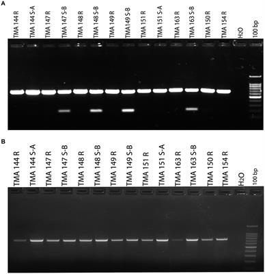 Unusually high clarithromycin resistance in Mycobacterium abscessus subsp. abscessus isolated from human gastric epithelium